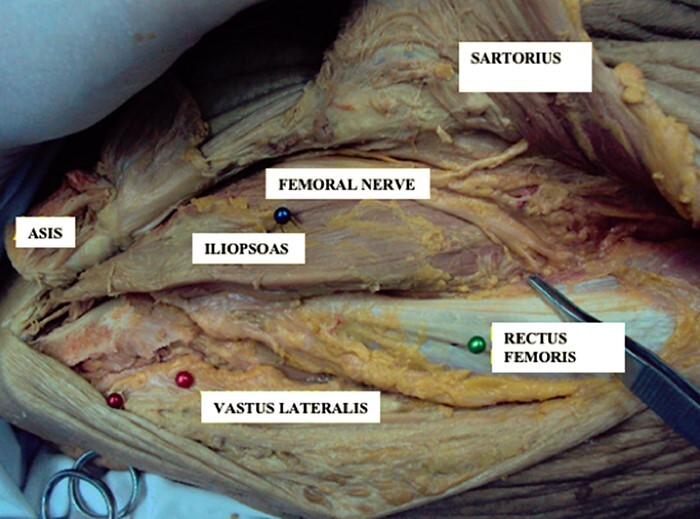 Fig. 4.