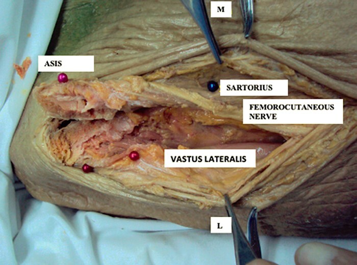 Fig. 3.