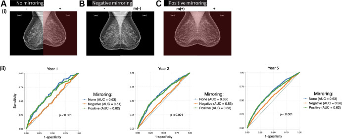 Top: Radiographic schema of mirroring experiment (only mediolateral oblique mammographic views shown for demonstration) shows no mirroring, as indicated by the original input screening mammogram with the known breast side of future cancer (+) and the unaffected breast side (−); negative mirroring, whereby the unaffected breast side (−) is mirrored, indicated by m (−), so that the input examination excludes the future affected breast (+); and positive mirroring, where the affected breast side is mirrored such that the input examination includes two copies of the future affected breast, indicated by m (+) and +. Bottom: Area under the receiver operating characteristic curves (AUCs) show Mirai performance in mirroring experiments (years 1, 2, and 5 from left to right). No mirroring and positive mirroring display superior model discrimination compared with negative mirroring at all time points.