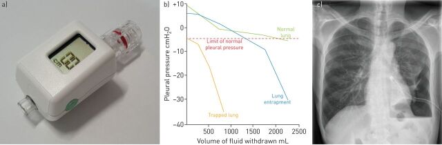 FIGURE 1