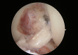 Fig 15