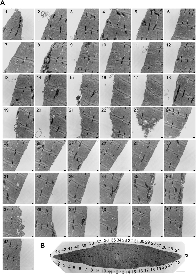 Figure 12—figure supplement 1.