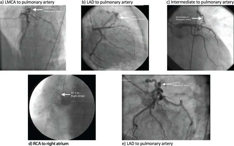 Fig.1