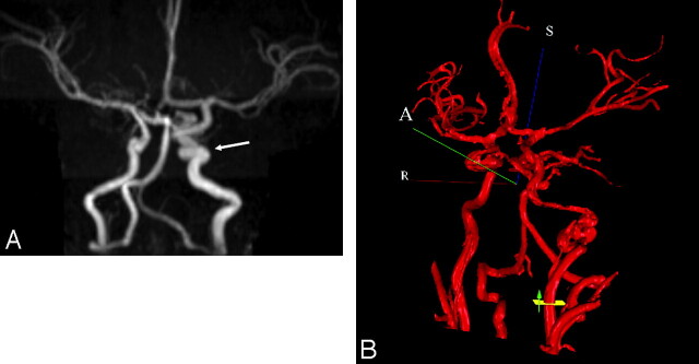 Fig 4.