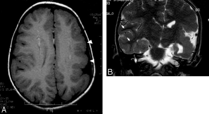 Fig 3.