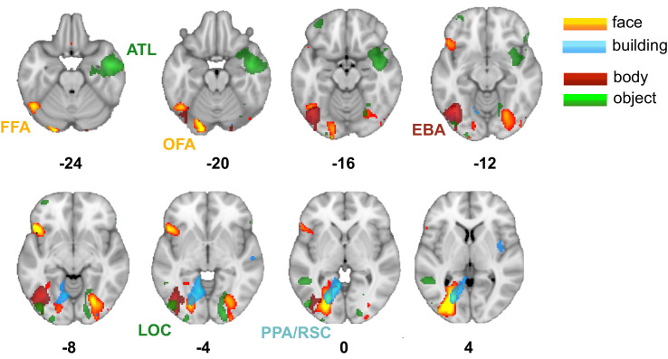 Figure 1—figure supplement 1.