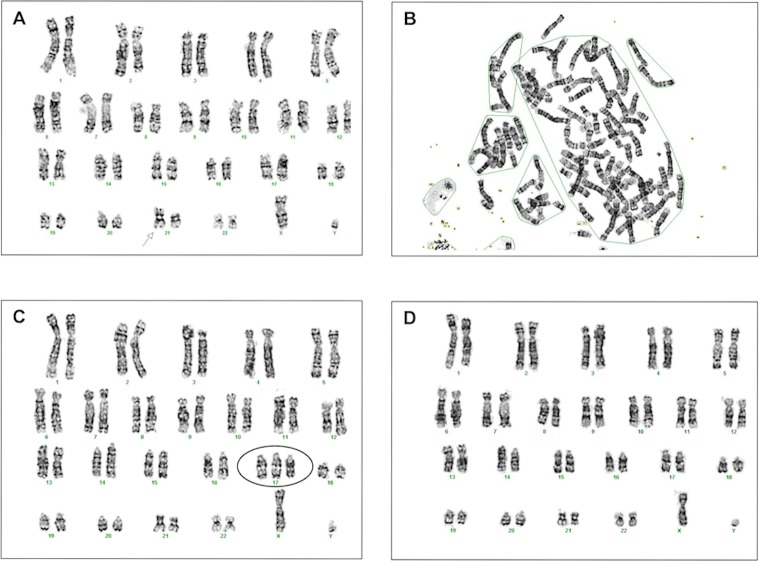 Fig 3