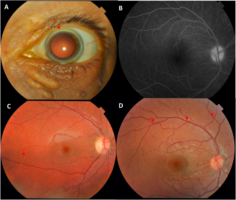 Fig. 1