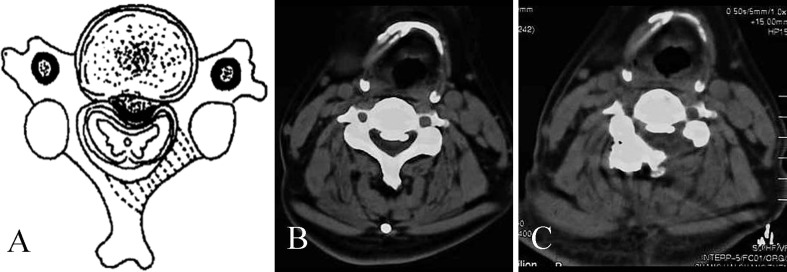 Fig. 2A–C