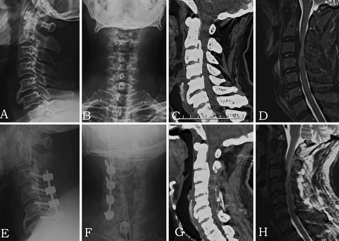 Fig. 1A–H