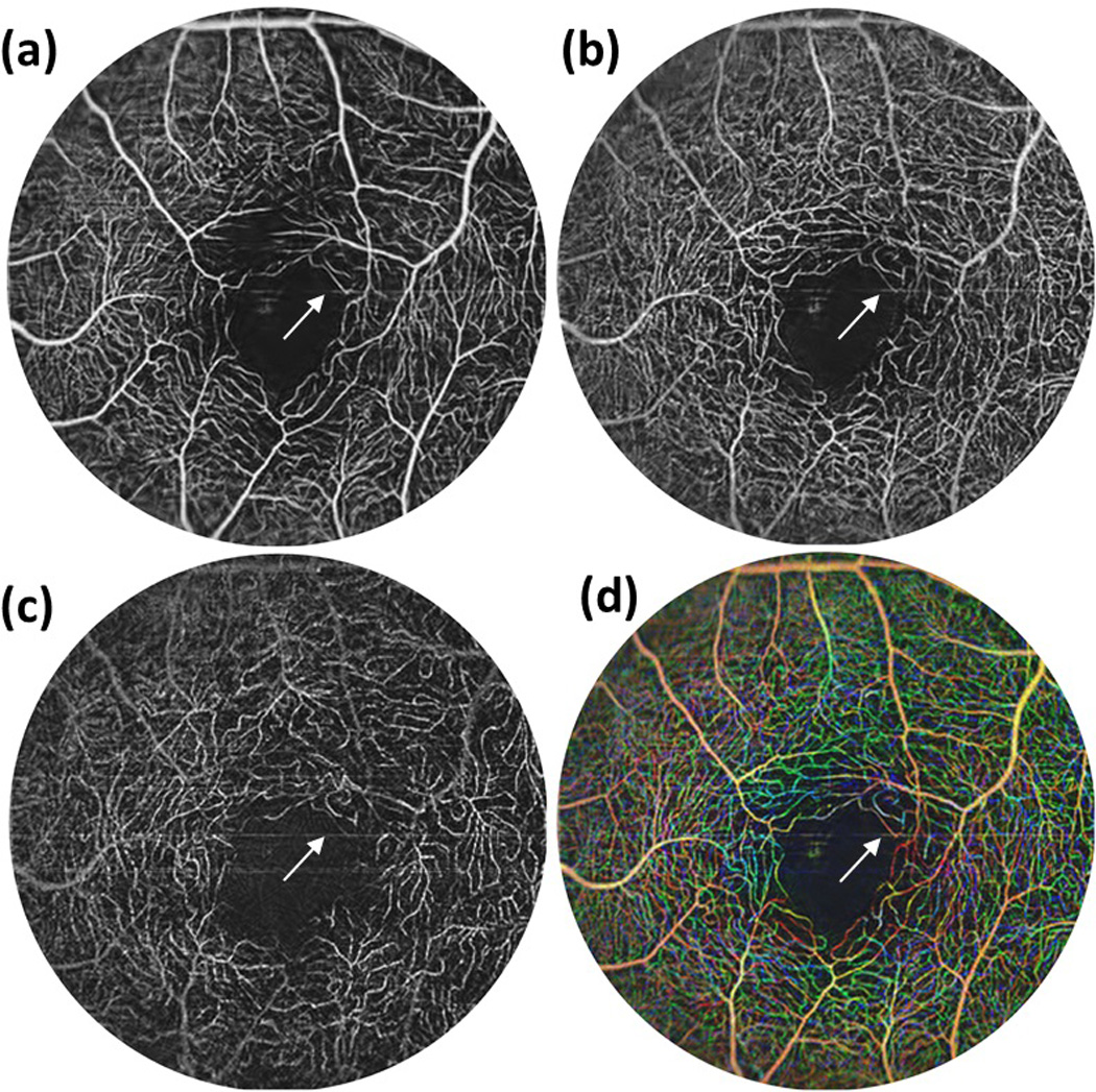 Figure 4