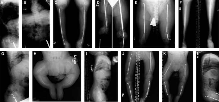 Box 1. Clinical case presentation: different phenotypes caused by identical or different mutations