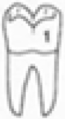 graphic file with name 12663_2014_731_Figb_HTML.jpg