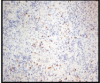 [Table/Fig-9]: