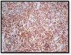 [Table/Fig-7]: