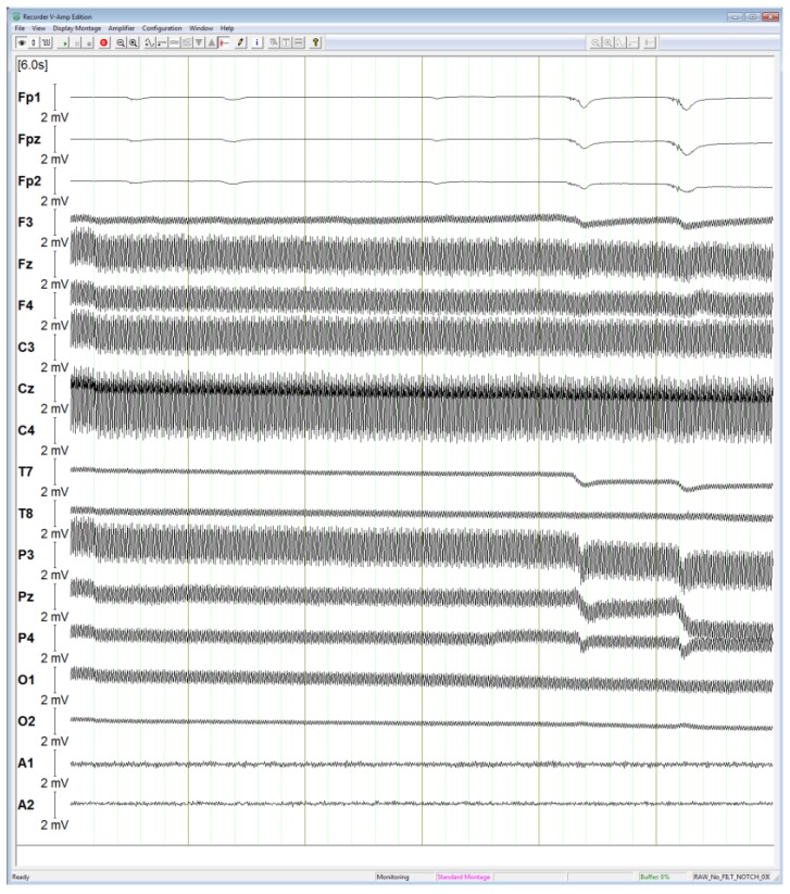 Figure 21