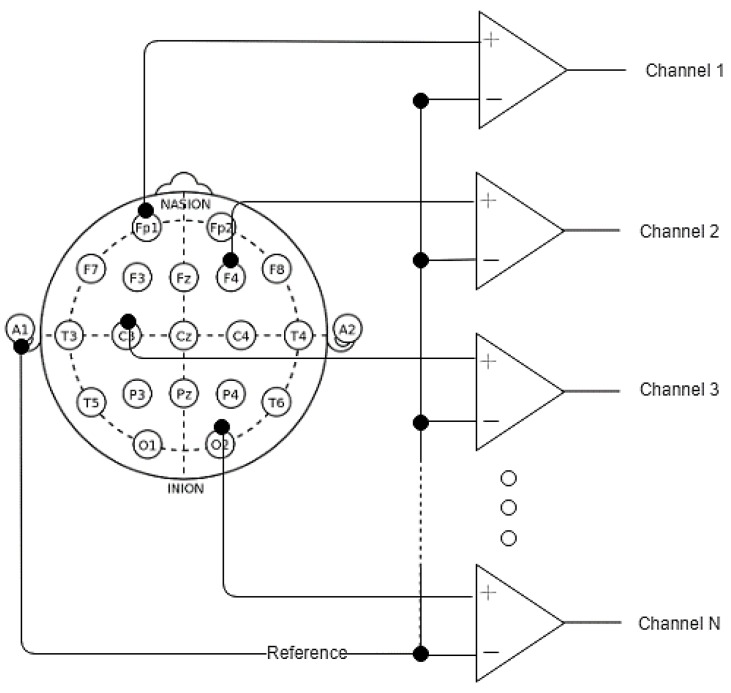 Figure 20