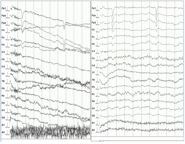 Figure 22