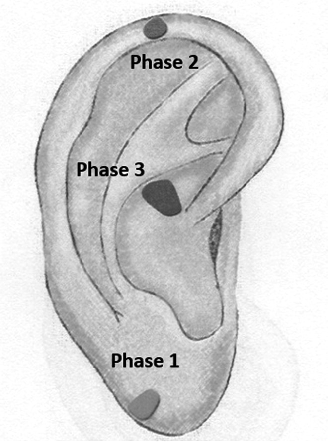 FIG. 1.