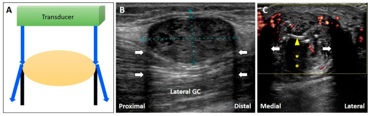 Figure 13