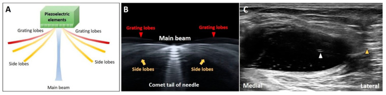 Figure 11