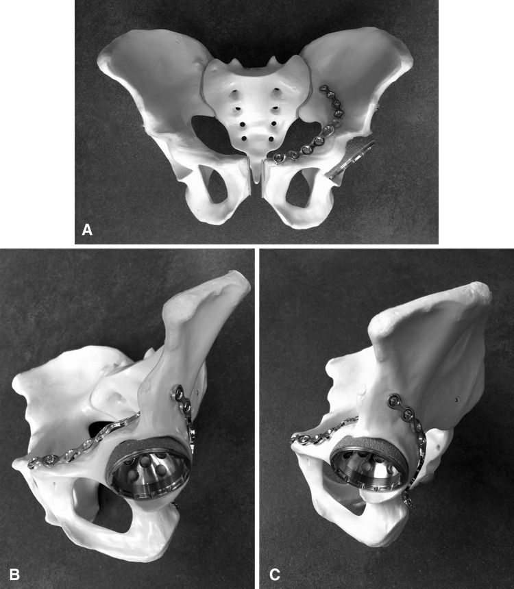 Fig. 3A–C