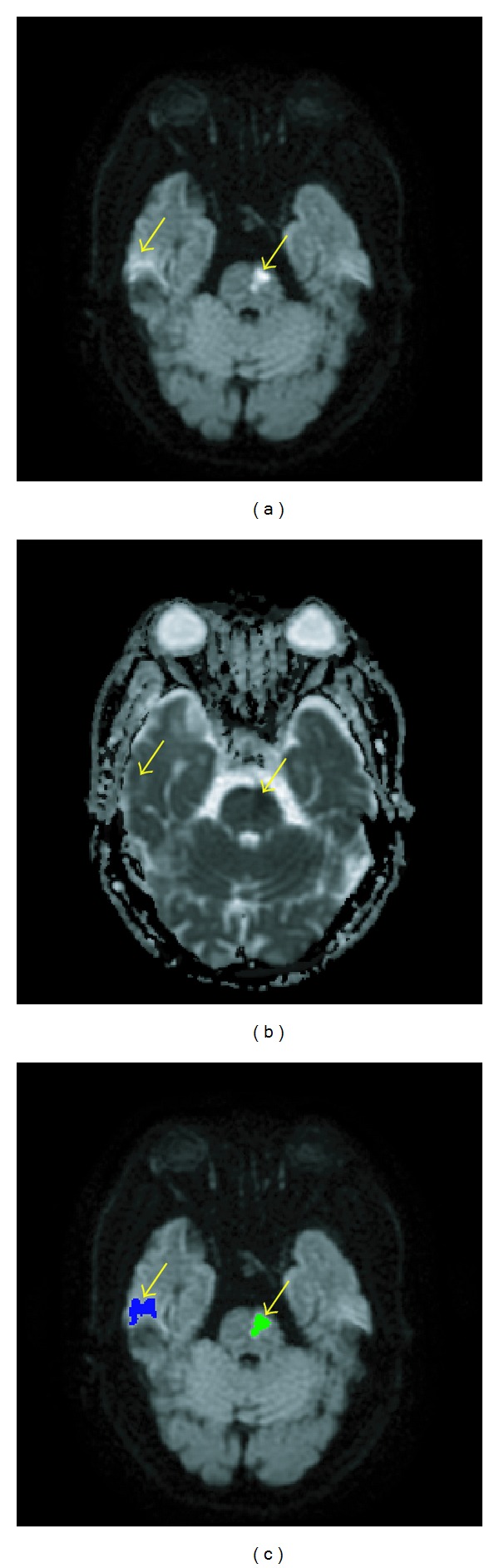 Figure 11