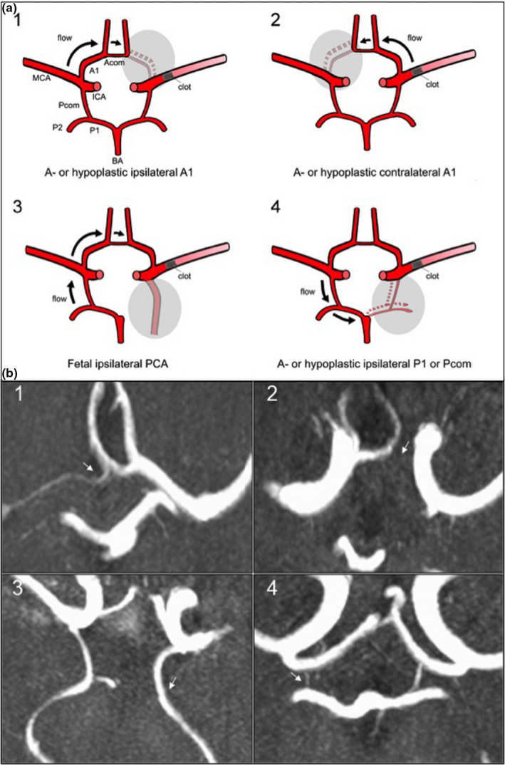 FIGURE 1