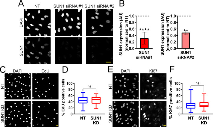 Figure 2—figure supplement 1.