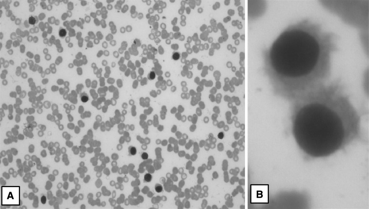 Fig. 1