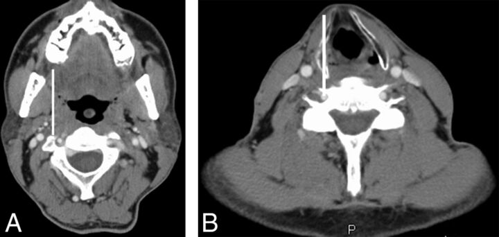 Fig 1.