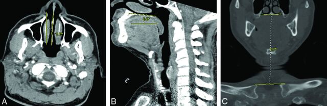 Fig 2.