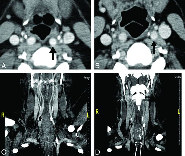 Fig 3.