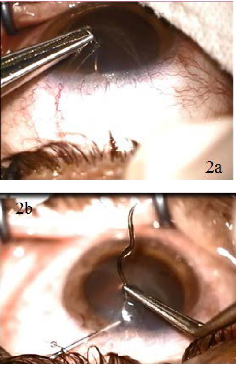 Fig. 2 a,b