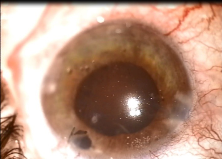 Fig. 4
