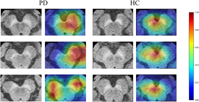 Fig. 4