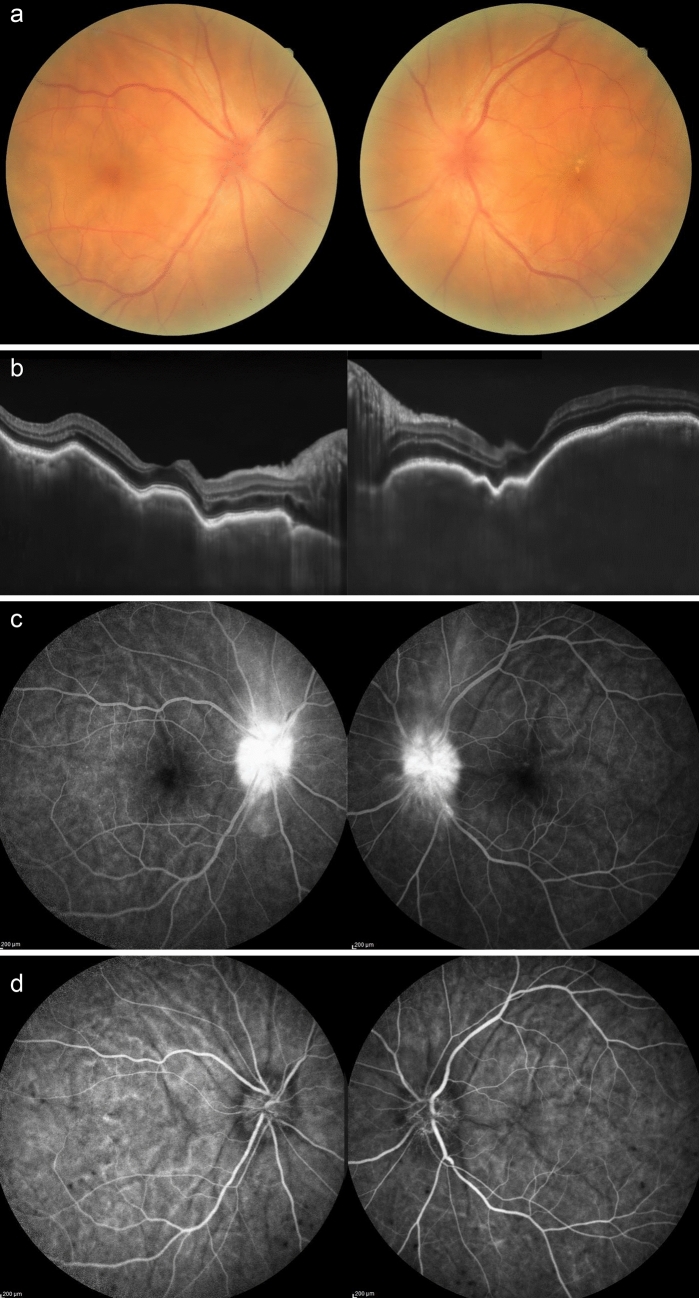 Fig. 3