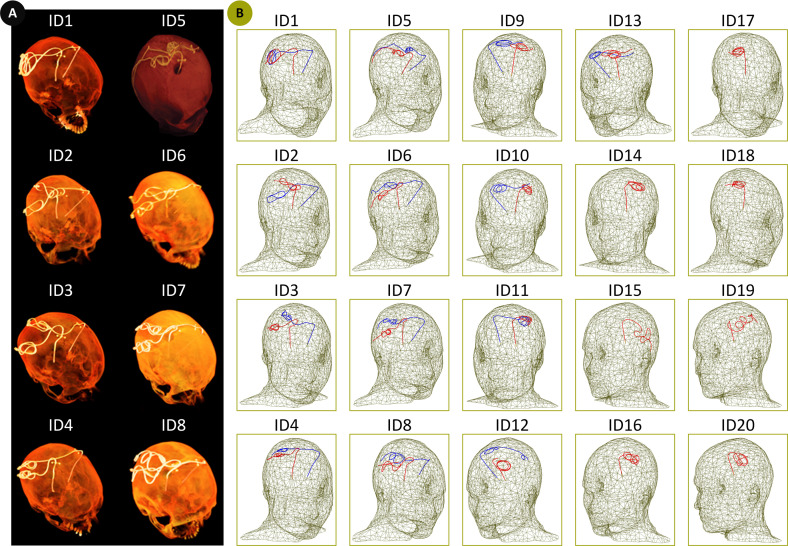 Fig 2