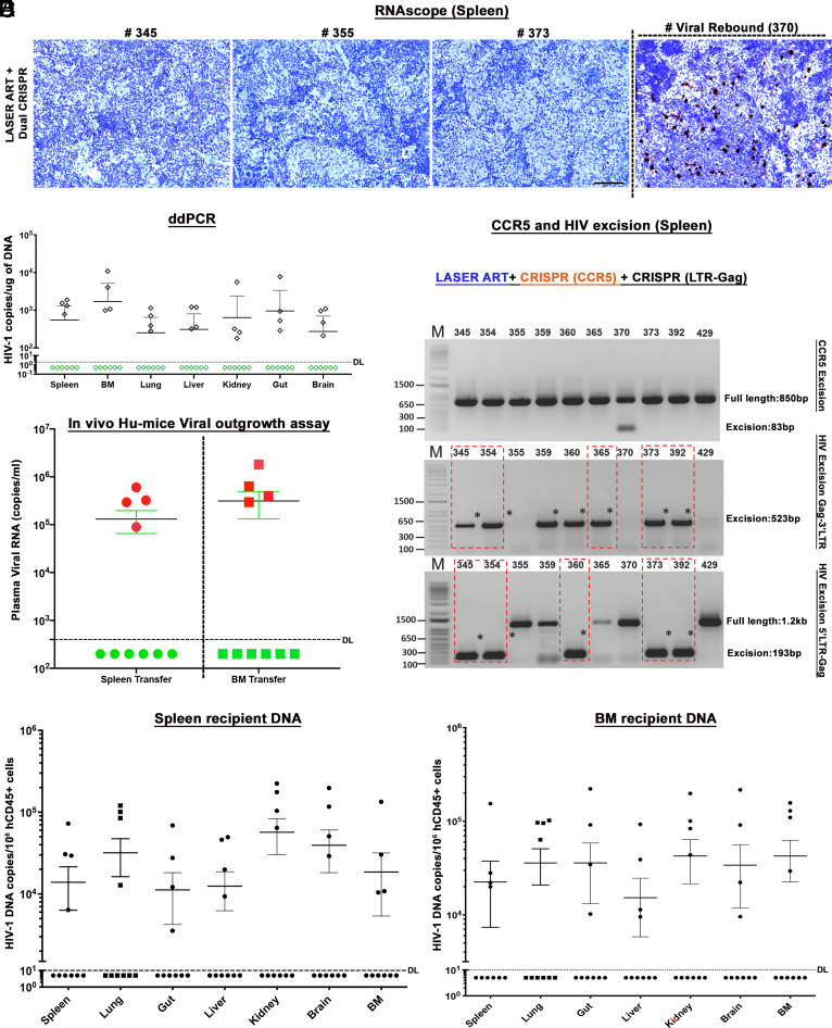 CRISPR editing of CCR5 and HIV-1 facilitates viral elimination in ...