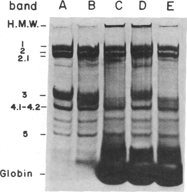 graphic file with name pnas00650-0176-a.jpg