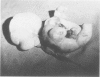 81