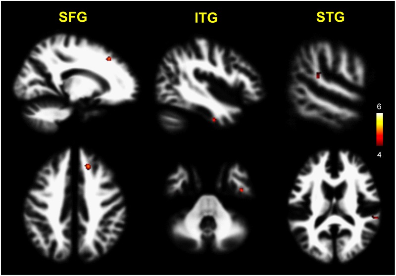 Fig 2