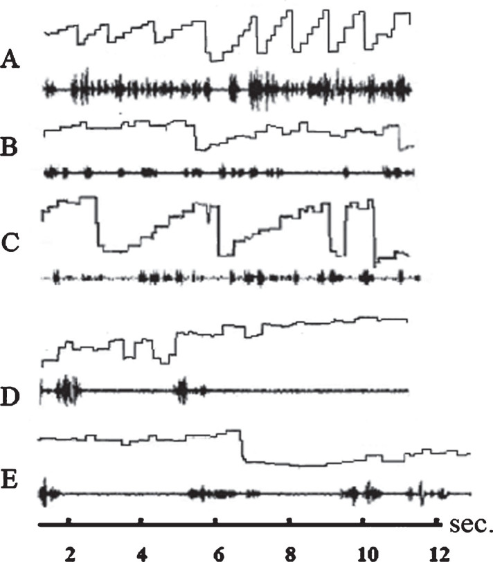 Fig.2