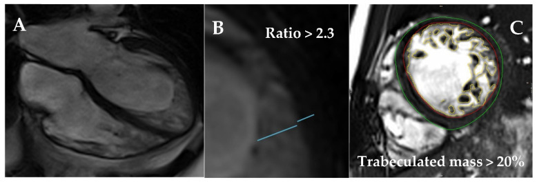 Figure 25