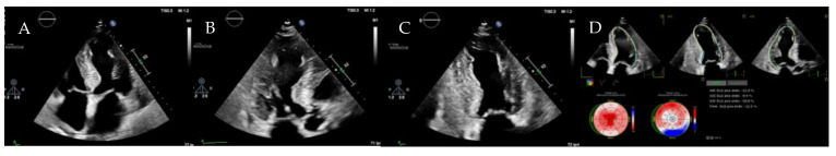 Figure 14