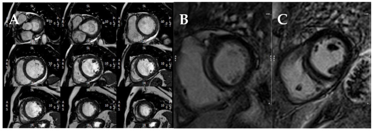 Figure 11