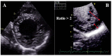 Figure 24