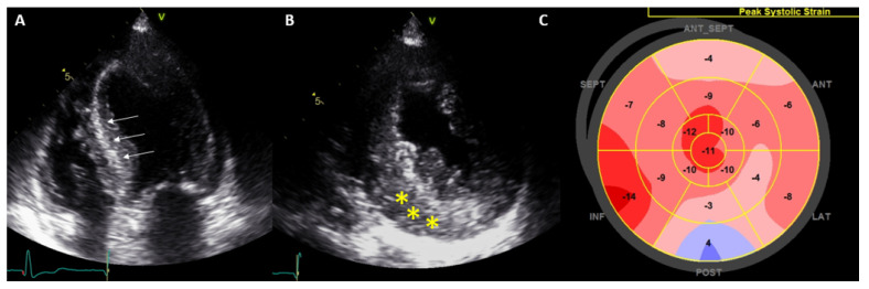 Figure 16