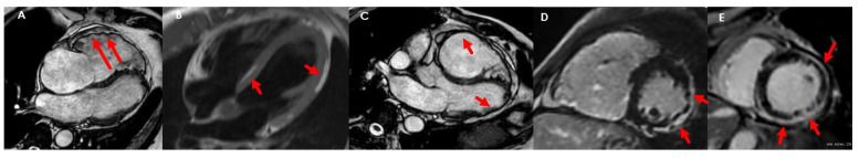 Figure 22