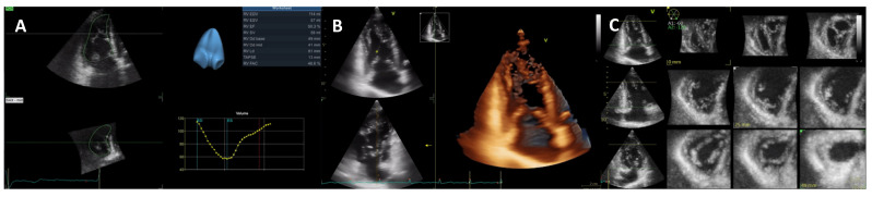 Figure 13